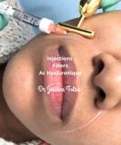 video thumbnail (5)