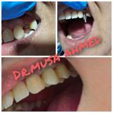 video thumbnail (3)