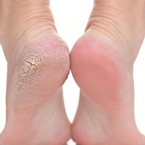Julia Juganaru (Medische Pedicure): Boek online een afspraak