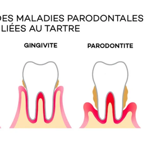 Parodontologie Cabinet dentaire wkl sourire (Dentiste): Prenez rendez-vous en ligne Parodontologie Cabinet dentaire wkl sourire (Dentiste): Prenez rendez-vous en ligne