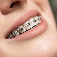 Orthodontie et traitement des dents pour les enfants  Service